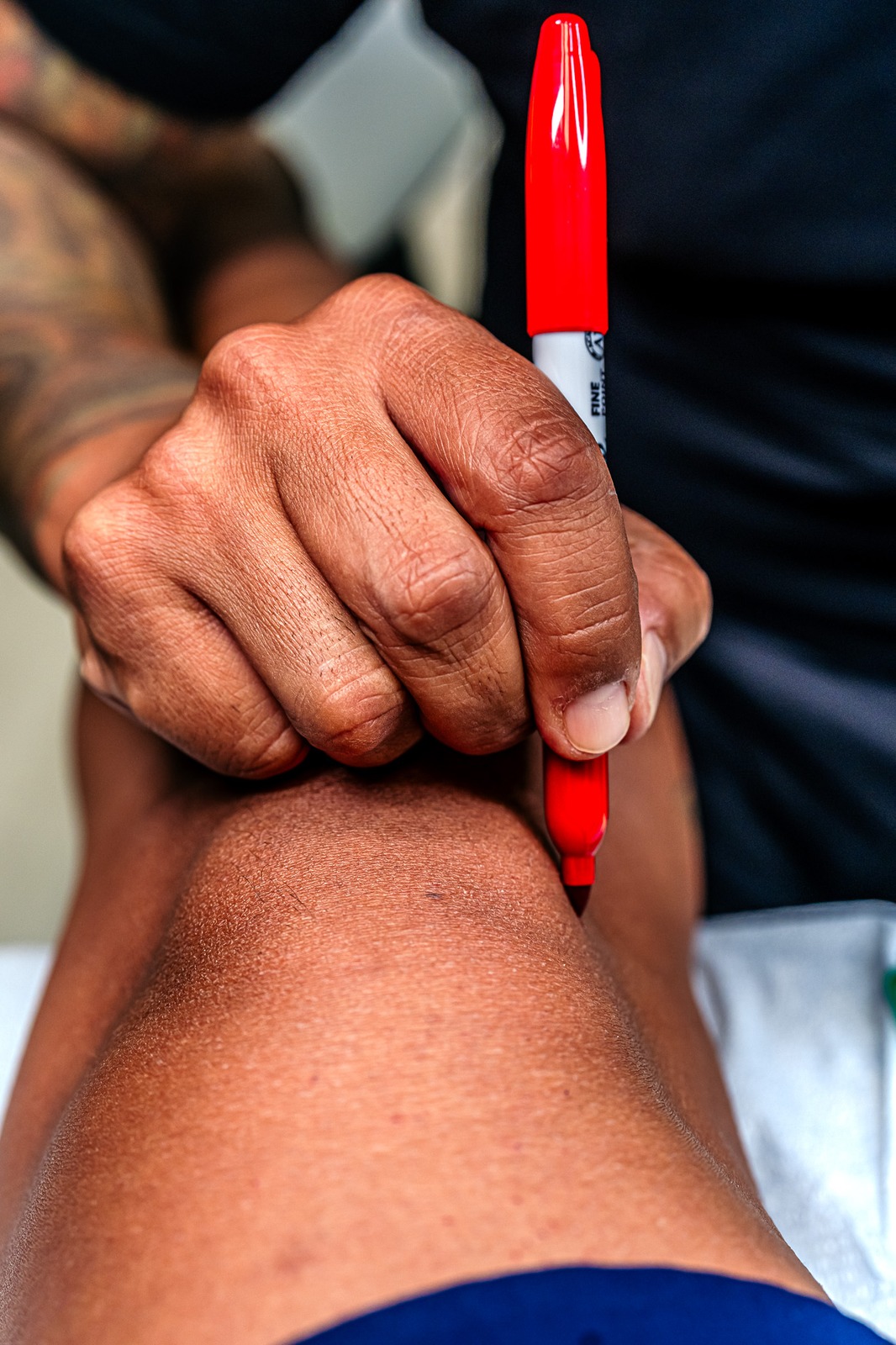 A person in a black top marks a knee with a red marker.