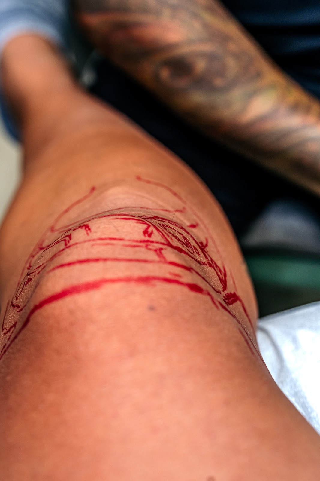 Red lines form a sketch on a knee.